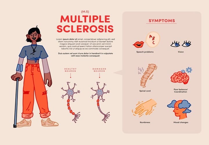 Multiple sclerosis (MS) – Common Symptoms