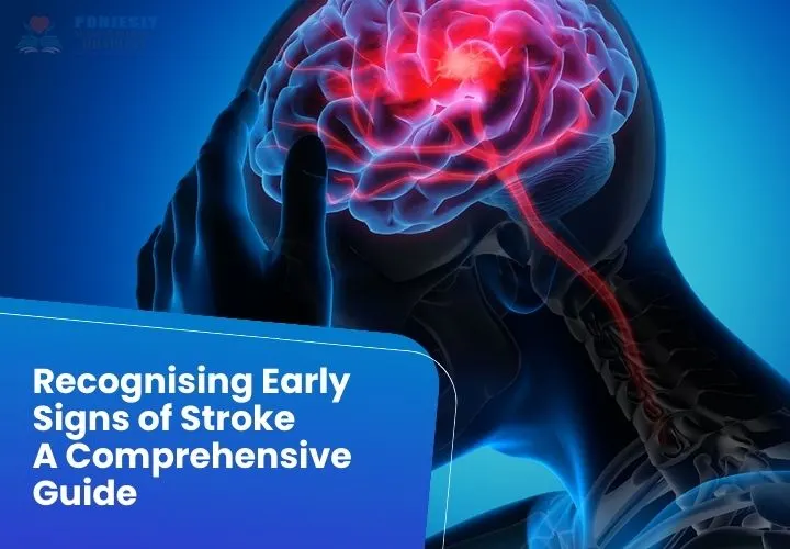 stroke
